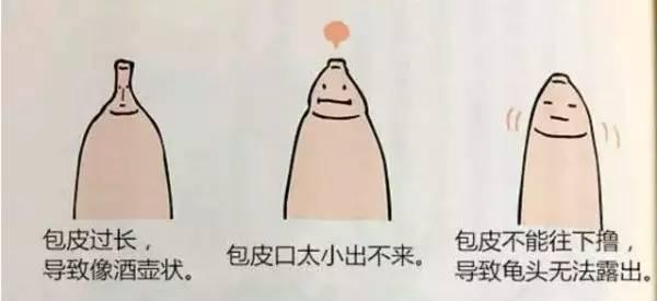 怎么看你的包皮过长吗