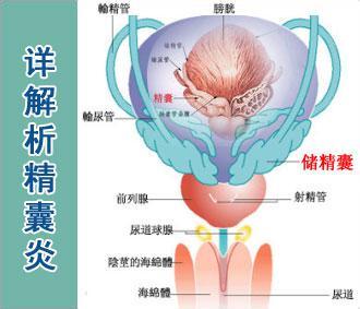 精囊炎、精囊囊肿与前列腺的关系-精囊疾病