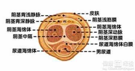 宜春先天性尿道下裂概述-阴茎阴囊转位