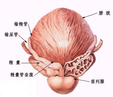 正确分清前列腺肥大和炎症